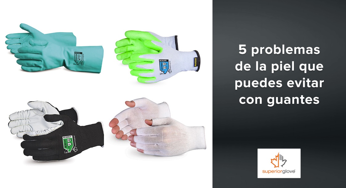5 problemas de la piel que puedes evitar con guantes Superior Glove